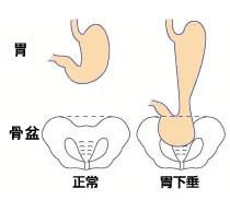 󳣴 θ´